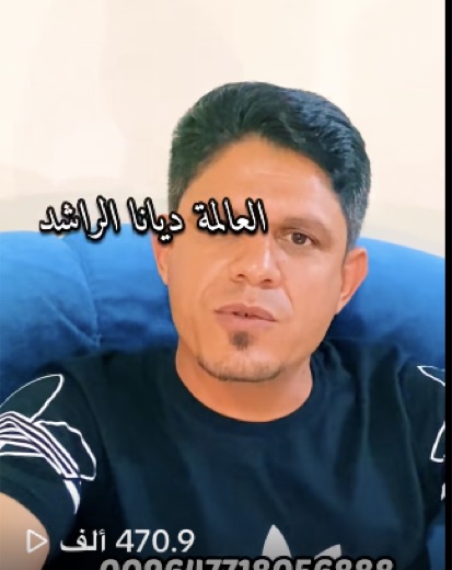 ظهر بوجهه وتحدّث عن تجربته